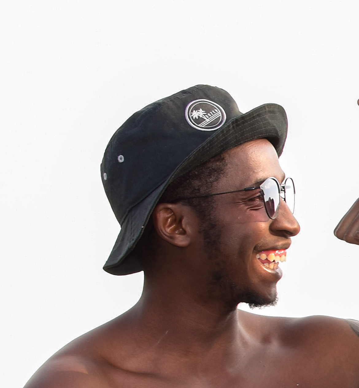 Rediscovering My Smile: A Journey from Childhood Cavities to a Fresh Start at 29!